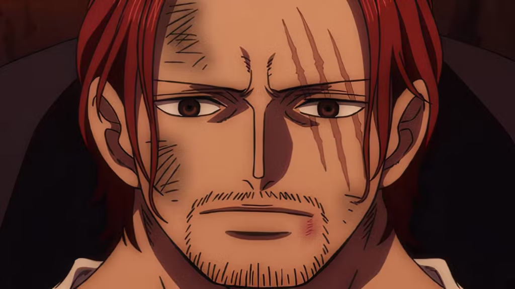 Shanks